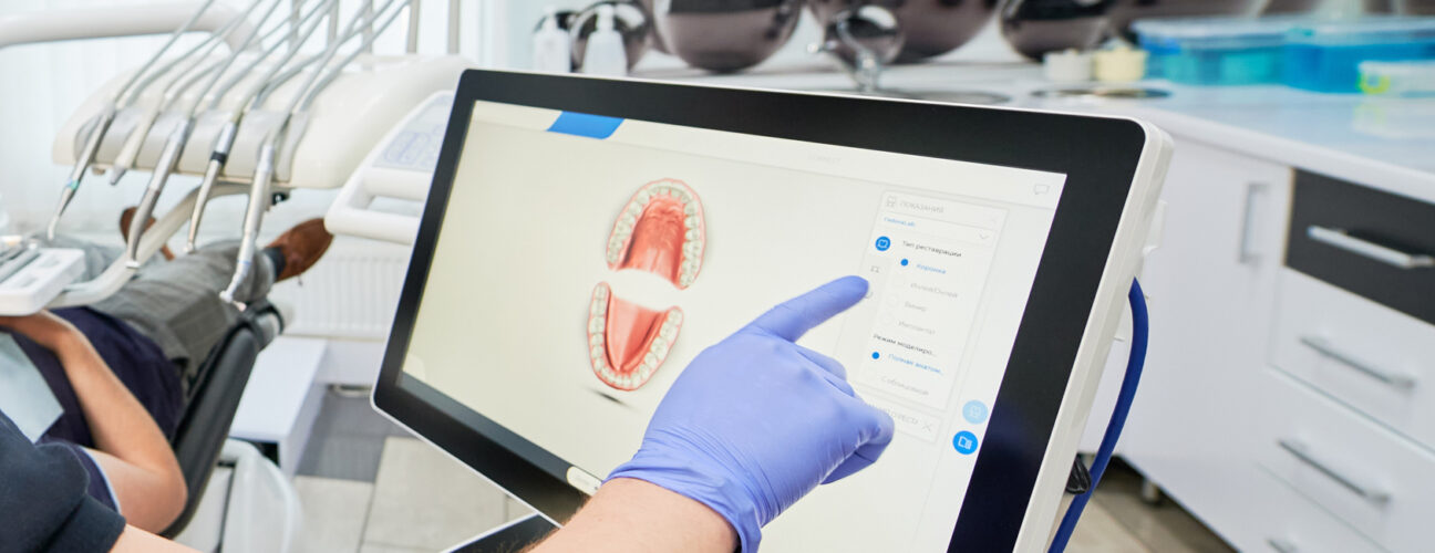 Intraoral Scanner