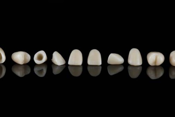 CEREC® Crowns Vs  Traditional Dental Crowns