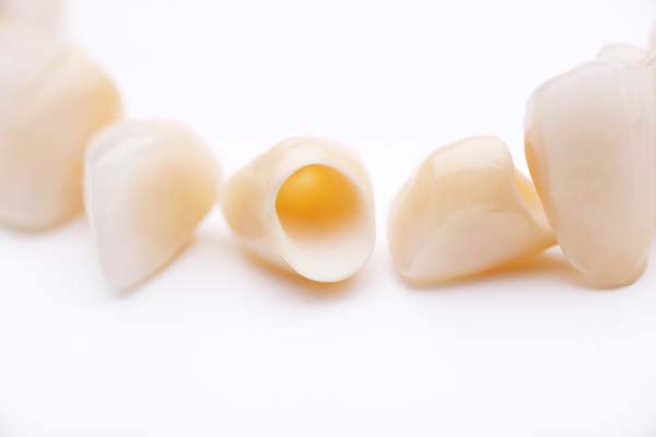 The Benefits Of Dental Crowns For Your Oral Health