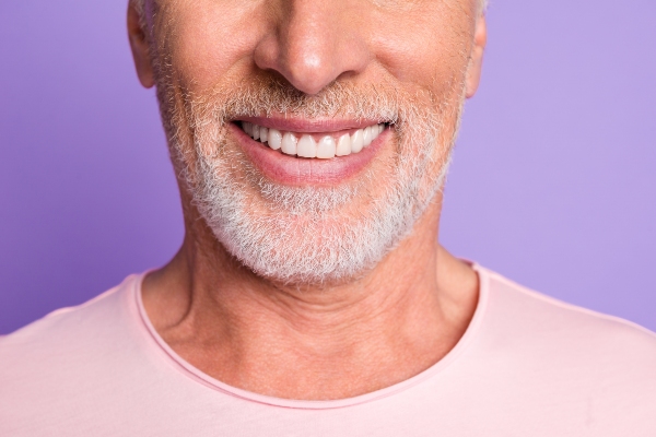 Benefits Of Porcelain Veneers
