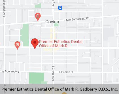 Map image for Emergency Dentist in Covina, CA