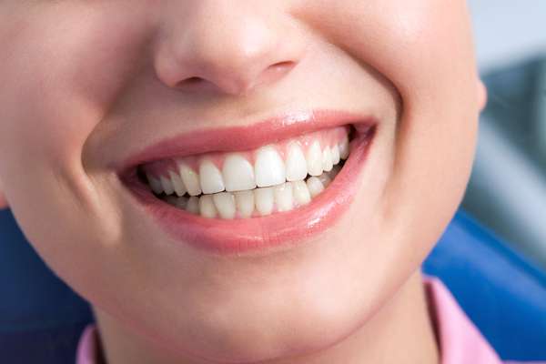 A General Dentist Discusses the Benefits of Tooth Straightening from Premier Esthetics Dental Office of Mark R. Gadberry D.D.S., Inc. in Covina, CA