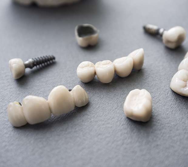 Covina The Difference Between Dental Implants and Mini Dental Implants