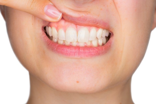 A Periodontist Can Help You Prevent Gum Disease