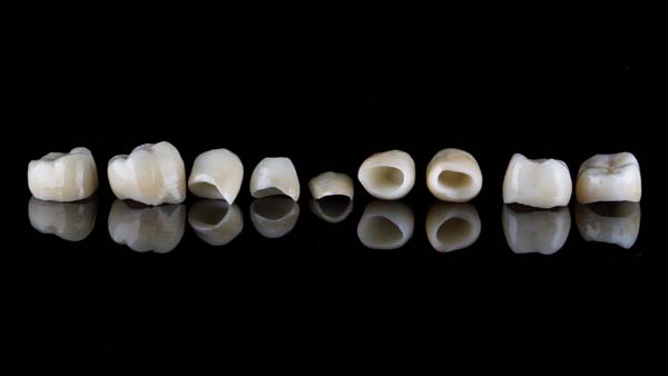 Same Day Dentistry A New Smile Now With Same Day Crowns Premier 